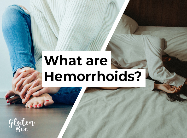 What are Hemorrhoids/Piles?
